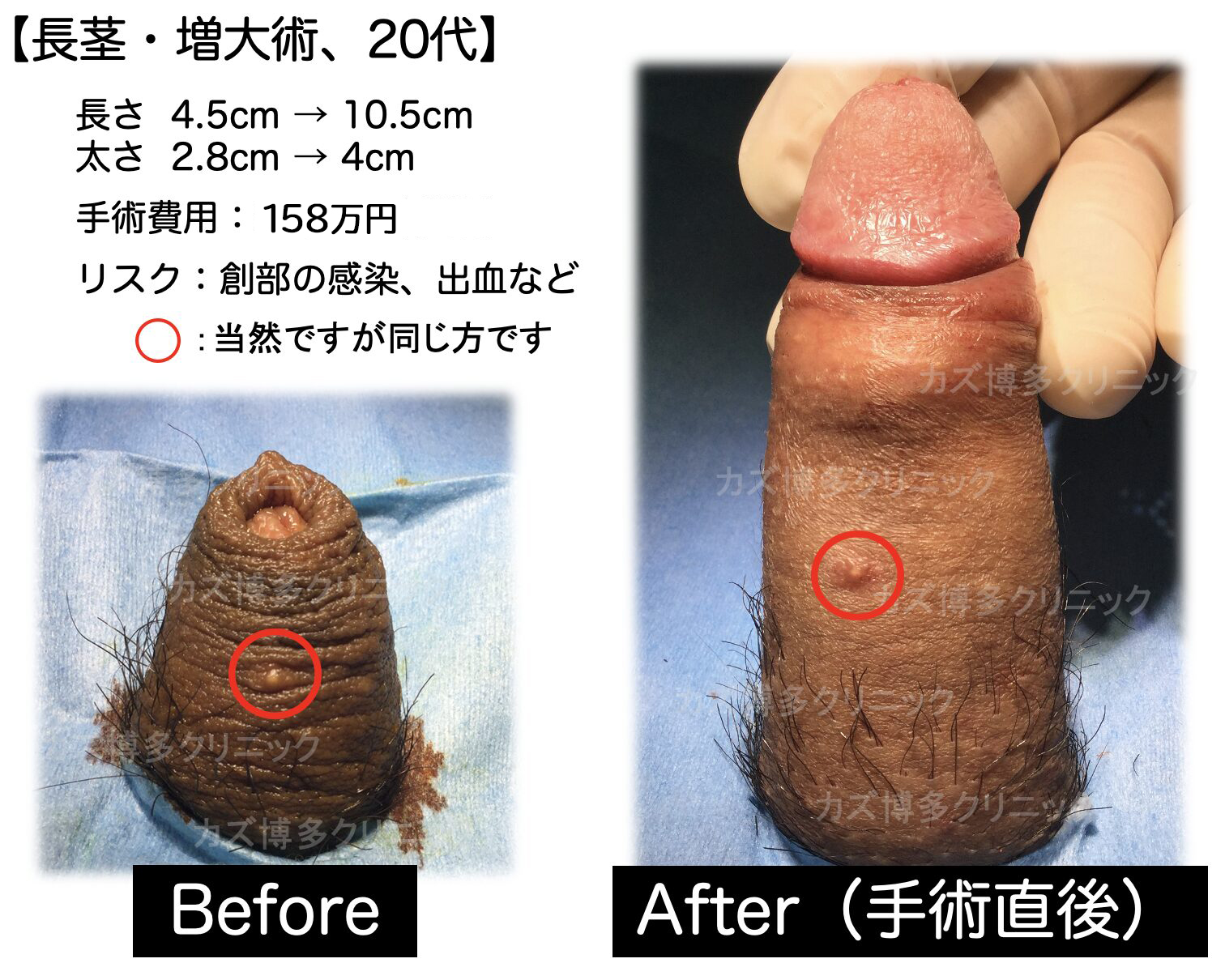 施術写真