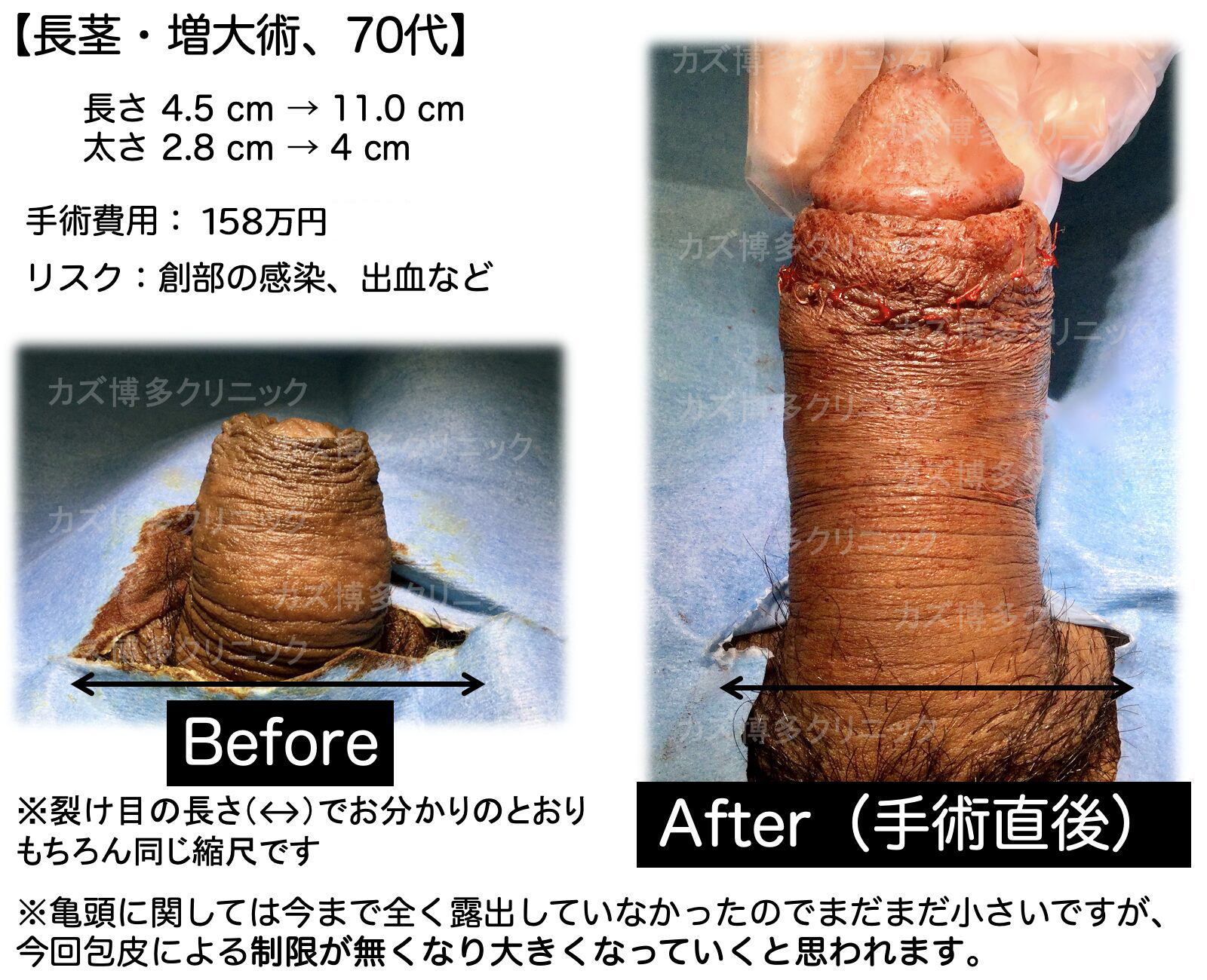 施術写真