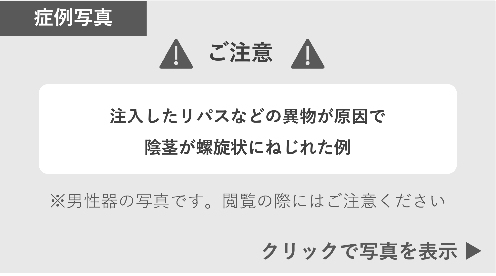 リパス注入などの異物が原因で陰茎が螺旋状にねじれた症例 症例写真閲覧の警告