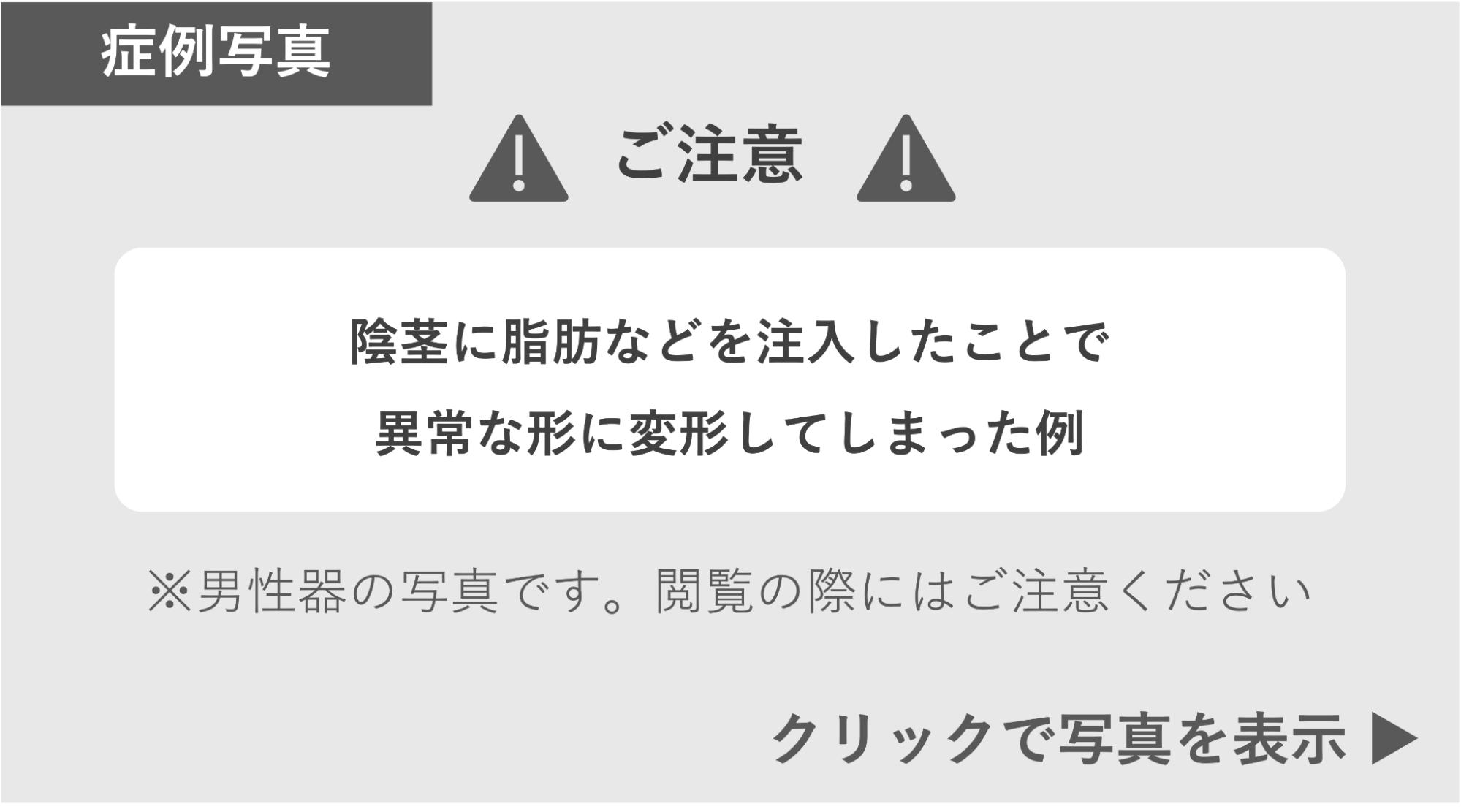 陰茎に脂肪などを注入したことで異常な形に変形してしまった症例 症例写真閲覧の警告