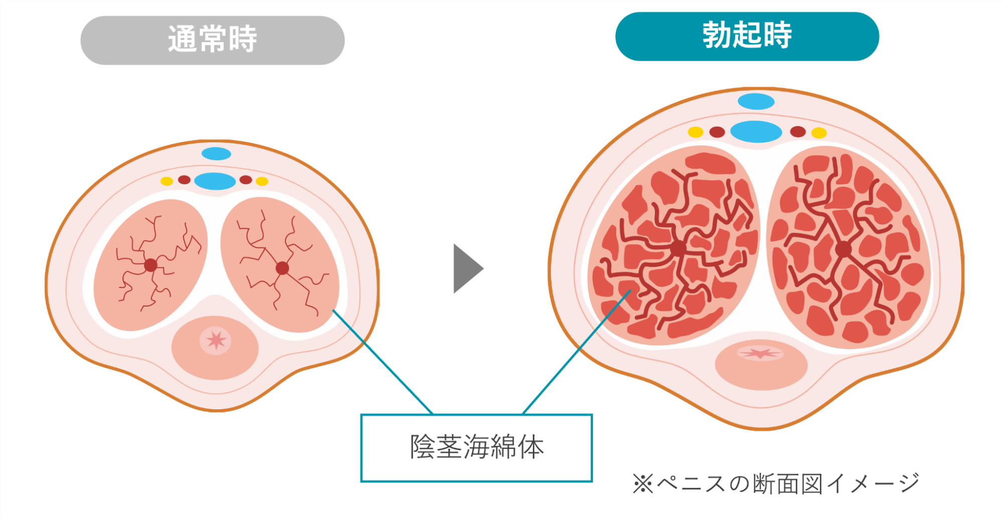 通常時と勃起時の陰茎海綿体のイメージ