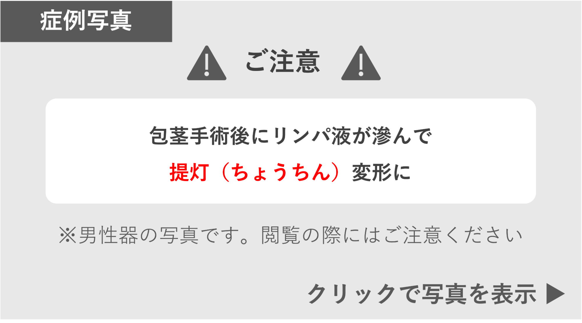 包茎手術後にリンパ液が滲んで提灯変形になった症例 症例写真閲覧の警告