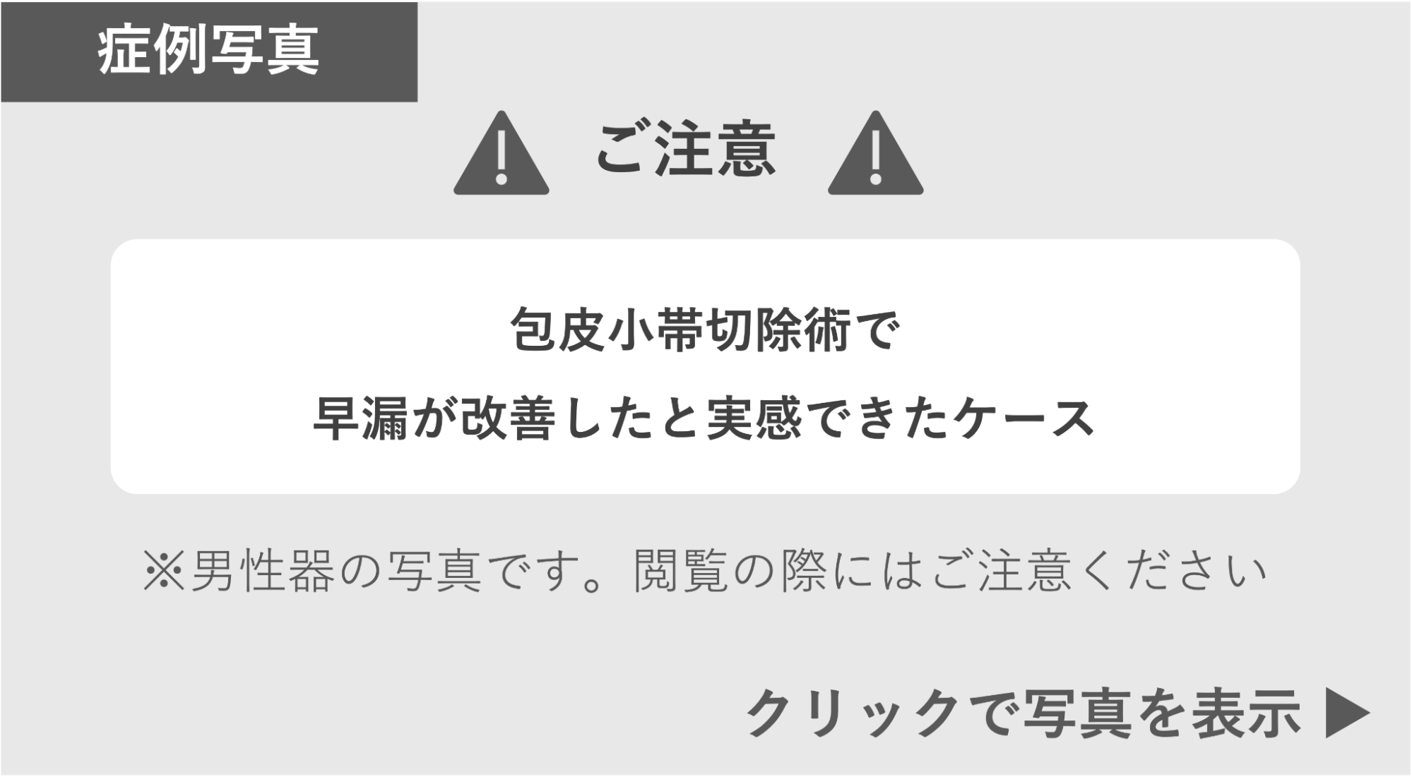 包皮小帯切除術で早漏が改善した症例 症例写真閲覧の警告