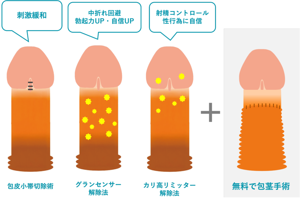 3つの手術のイメージとメリットを説明した図