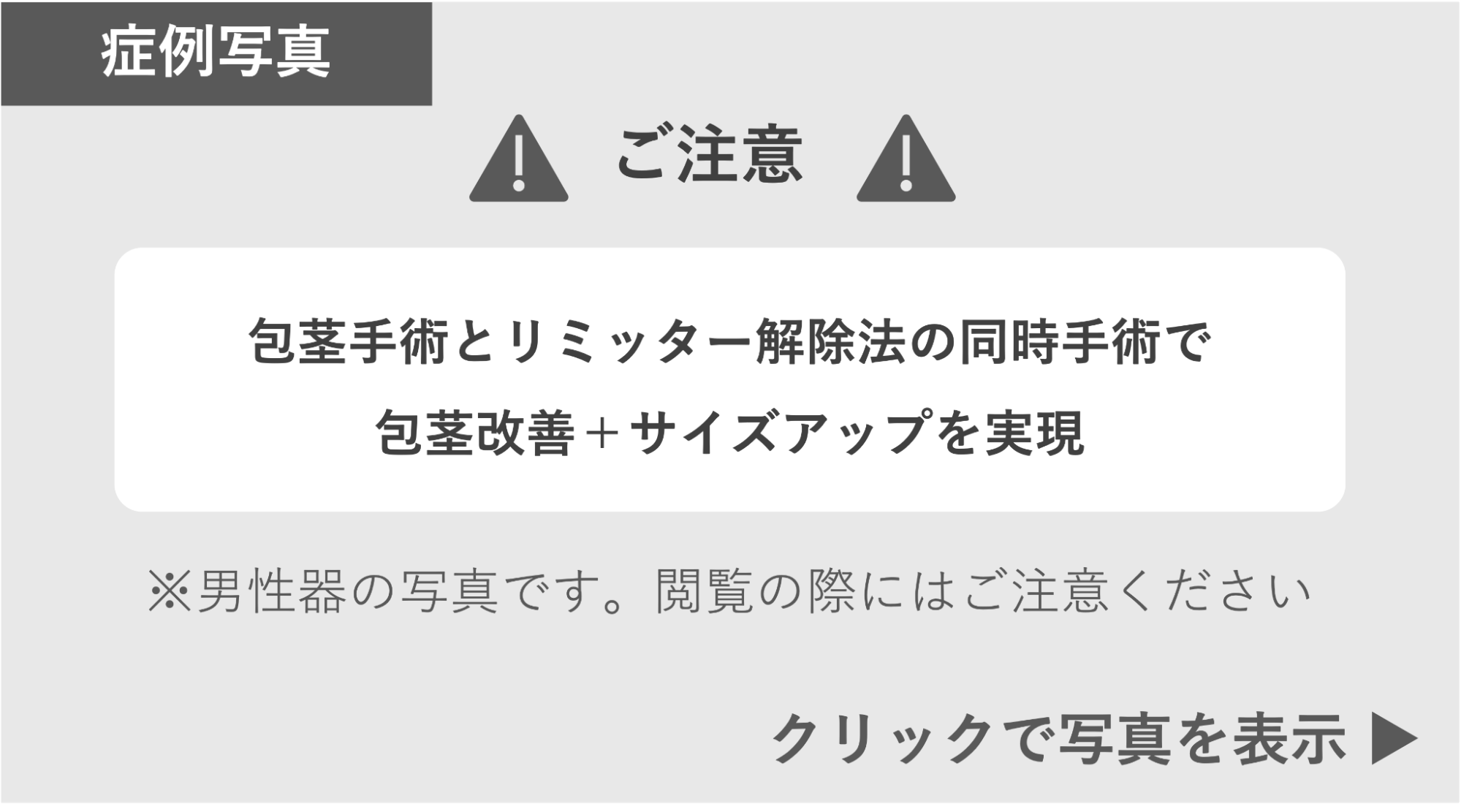 包茎手術とリミッター解除法の同時手術をした症例 症例写真閲覧の警告
