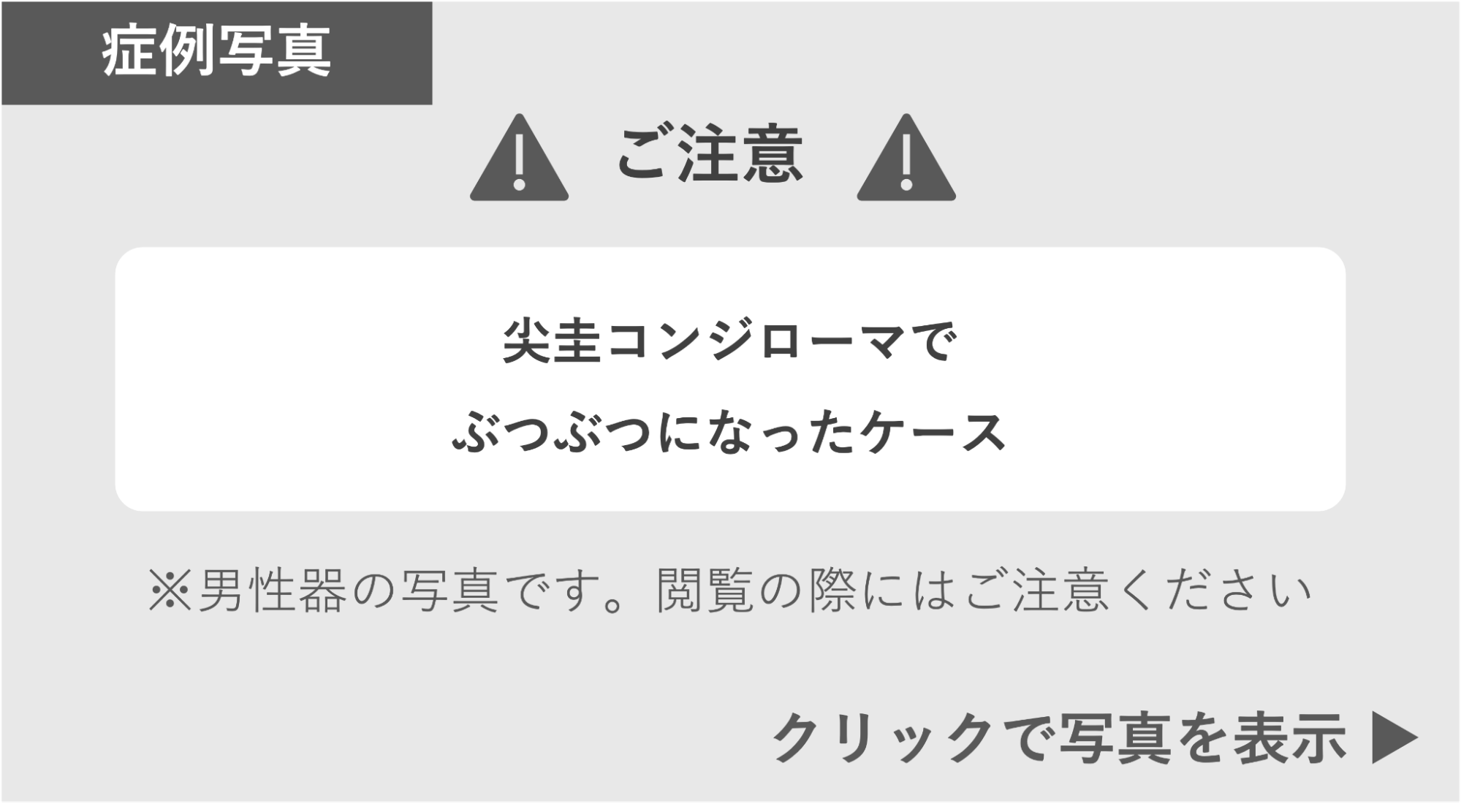 尖圭コンジローマでぶつぶつになった症例 症例写真閲覧の警告