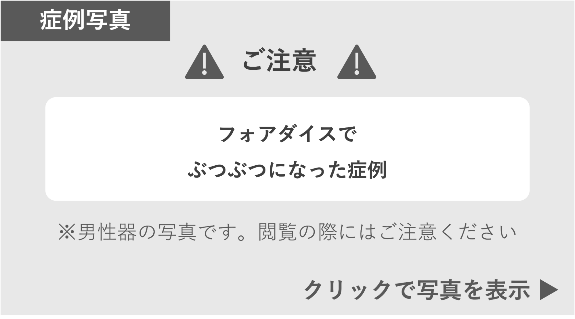 ファボタイスでぶつぶつになった症例 症例写真閲覧の警告