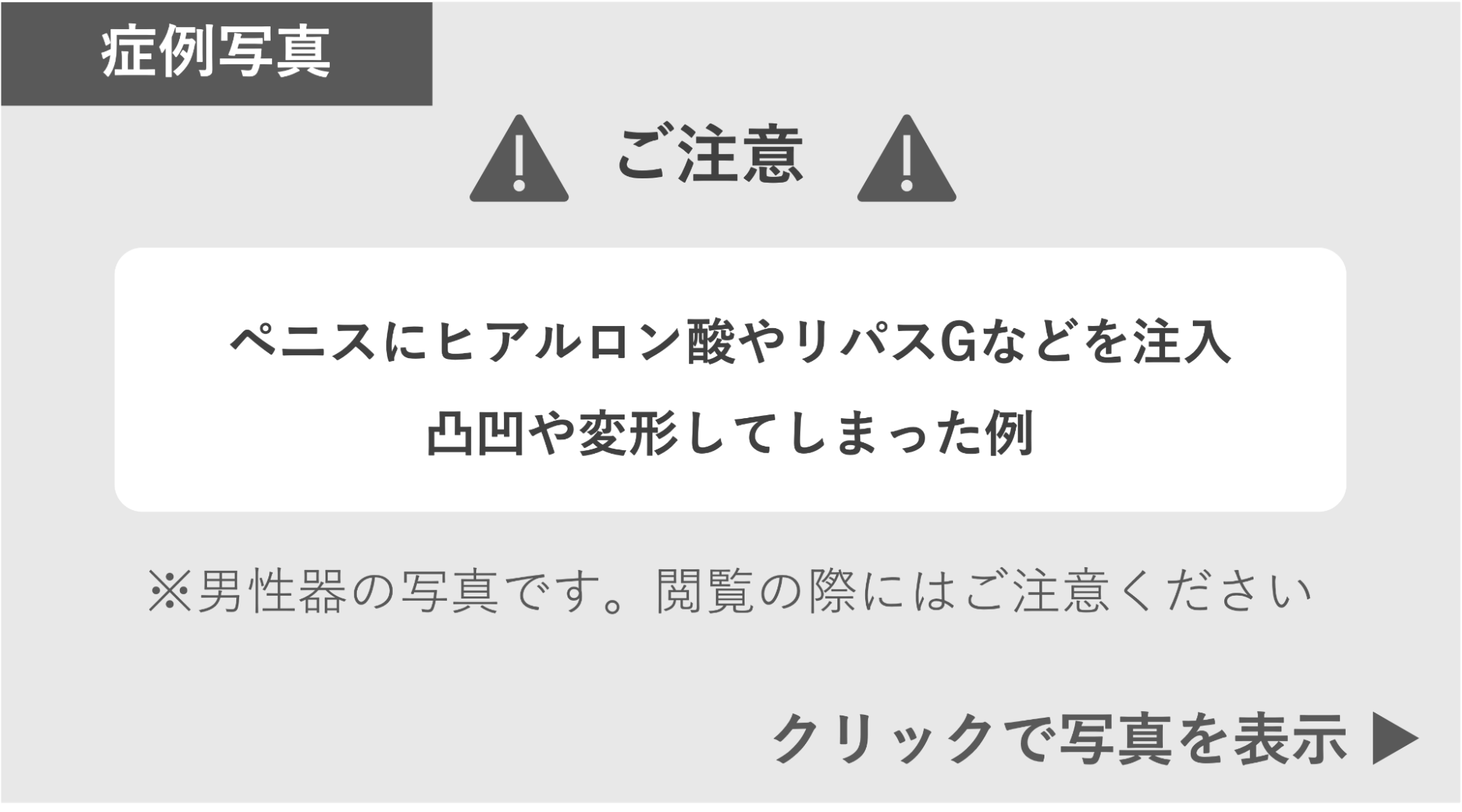 ヒアルロン酸やリパスGなどの注入で変形した症例 症例写真閲覧の警告