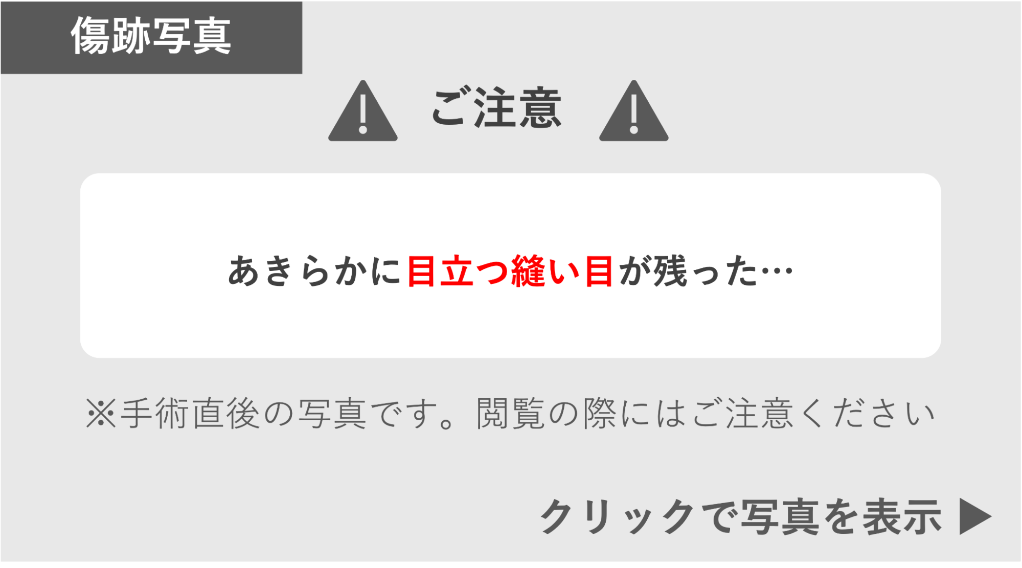あきらかに目立つ縫い目が残った症例 症例写真閲覧の警告