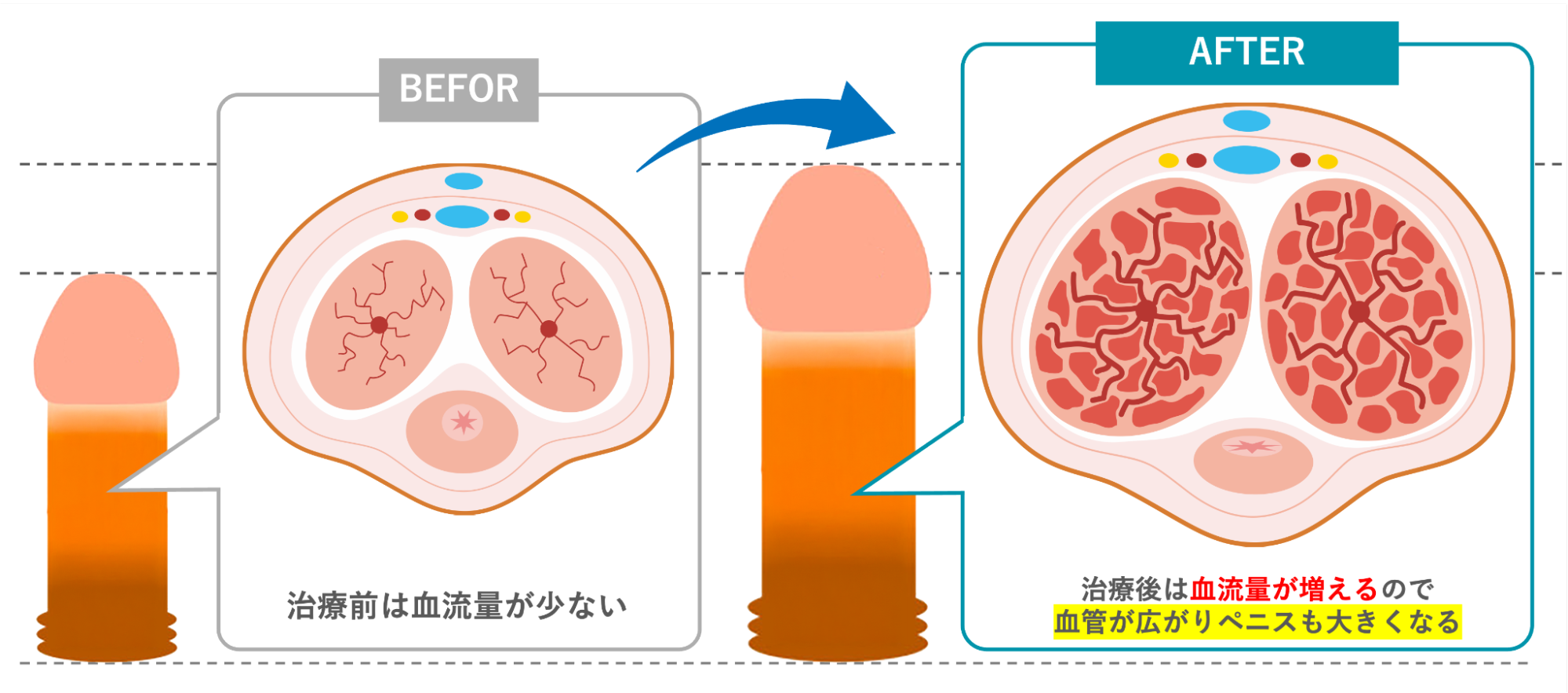 カリ高リミッター解除法でペニスが大きくなる理由を説明した図