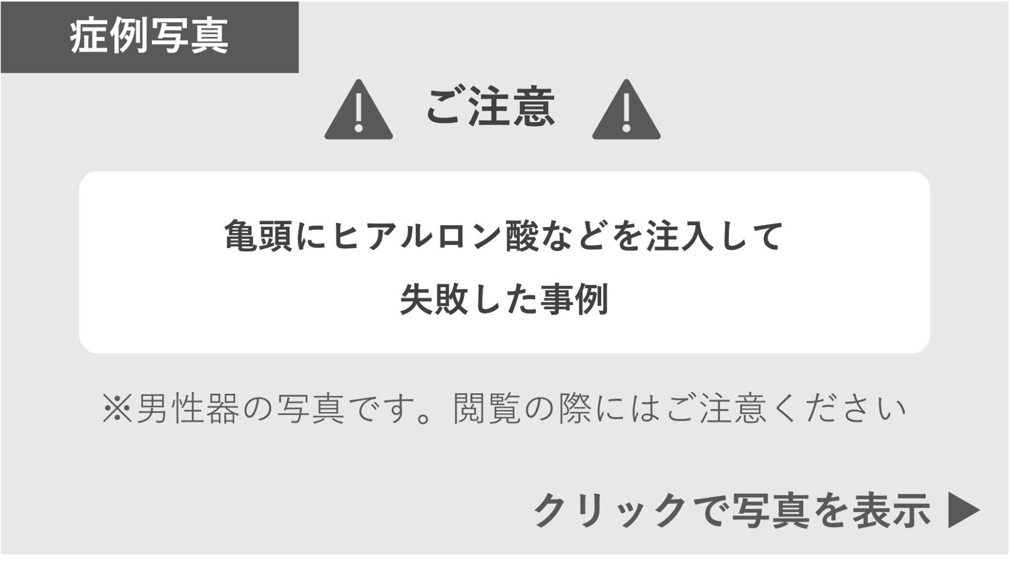 亀頭にヒアルロン酸など注入して失敗した症例 症例写真閲覧の警告